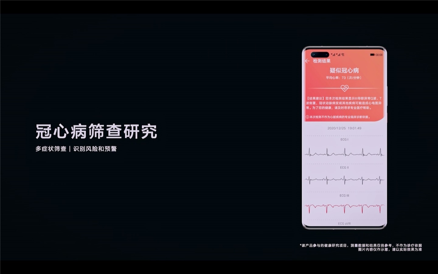 我国科研人员开发可穿戴监测系统为帕金森病早期干预提供可能