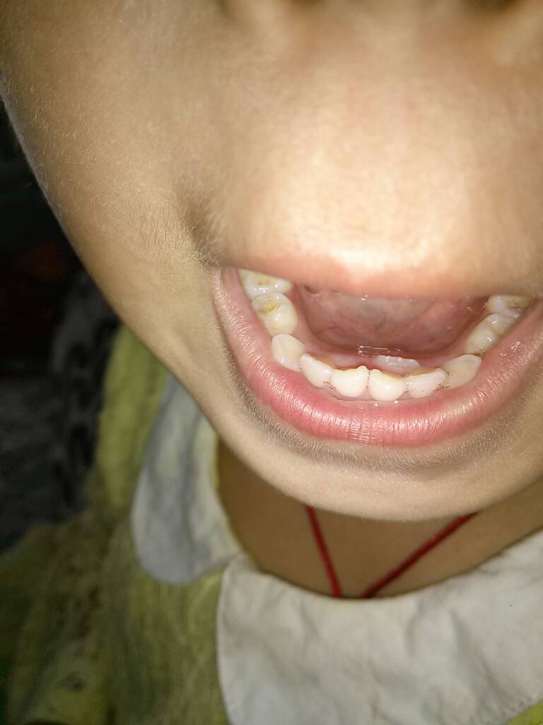 从“长牙带刺”到“精准拆弹” 监管“零容忍”升级